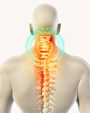سبک زندگی و ضعف عضلات؛ دو عامل مهم در بروز مشکلات گردنی